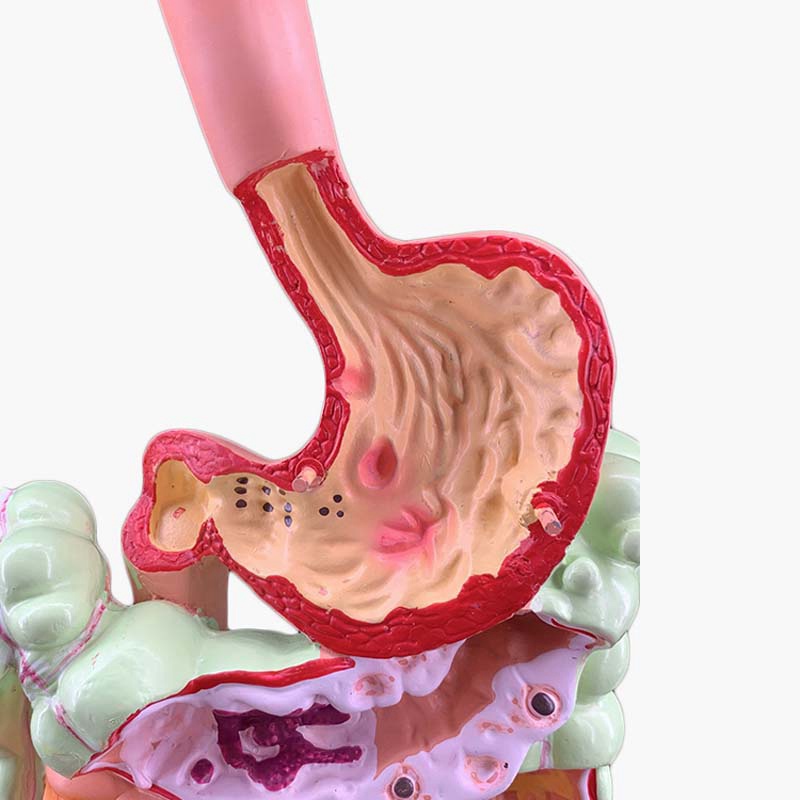 Mô Hình Cấu Trúc Nội Thất Cơ Thể Người Kích Thước Lớn Ruột Lớn Cecum Duodenum