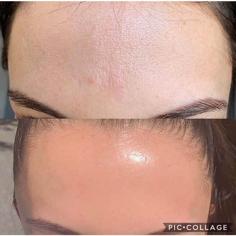 TINH CHẤT SIÊU PHỤC HỒI SERUM SILISCA PANTHENOL B5 CICATRIES COPPER TRIPEPTIDE-1