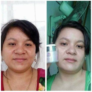 Kem Face Trắng Da Dạng Lotion Mwhite