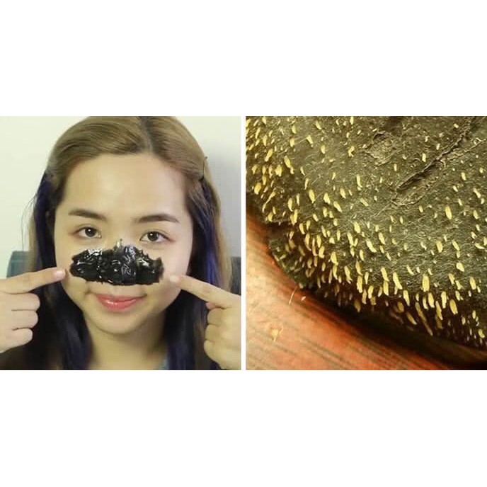 Gel lột mụn bùn than tre lê thanh