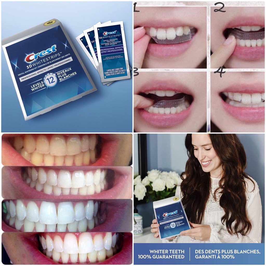Miếng Dán Trắng Răng CREST 3D WHITESTRIPS Chính hãng