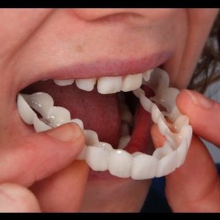 [BÁN CHẠY] Dụng cụ niềng răng tại nhà snapon smile - nẹp răng tại nhà