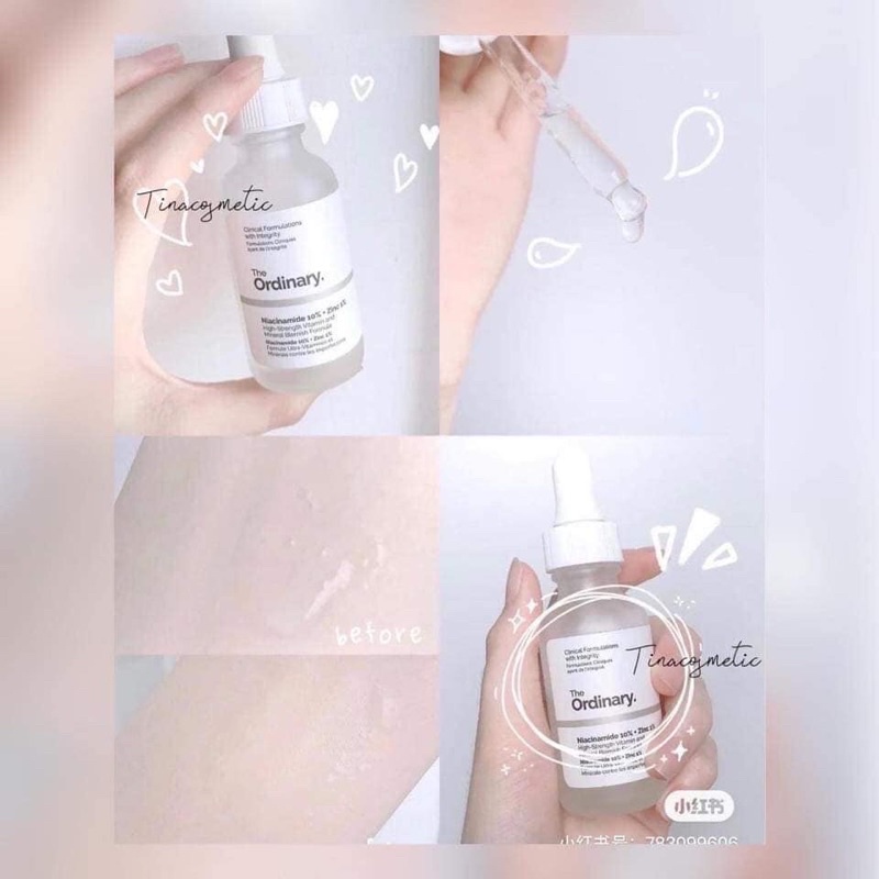 Tinh chất dưỡng sáng mờ thâm The Ordinary Niacinamide 10% + ZinC 1% 30ml