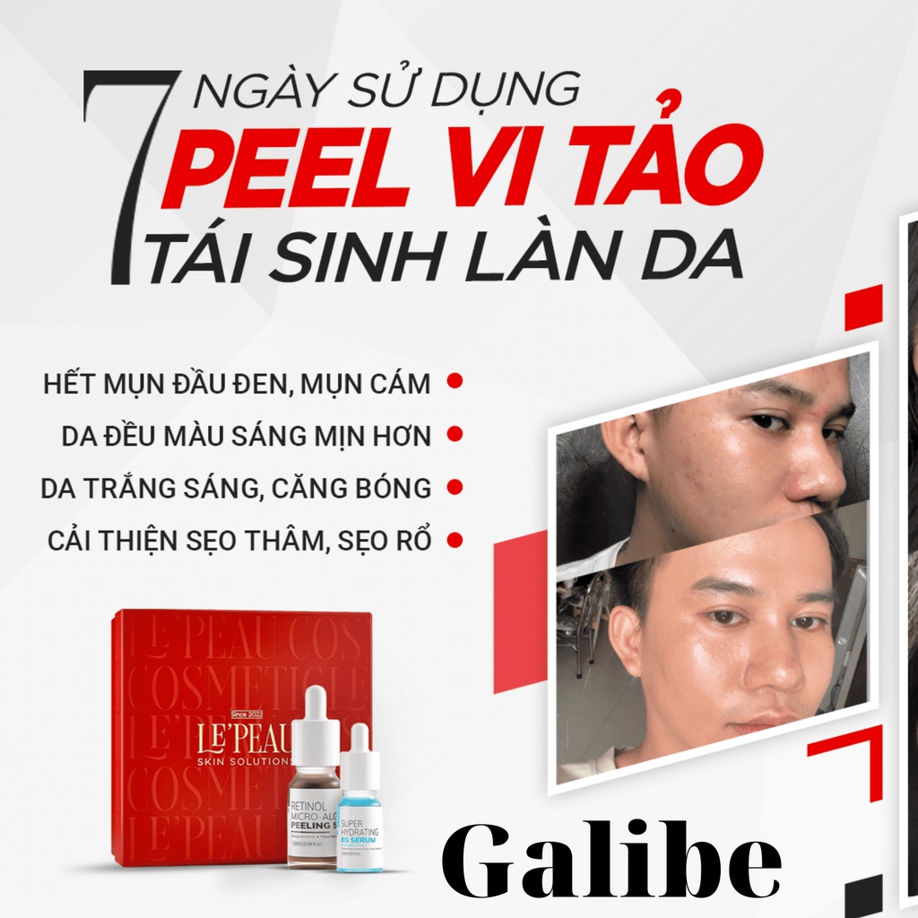 Peel da vi tảo LE PEAU peel da retinol, thay da sinh học giảm thâm, giảm sạm nám GALIBE OFFICIAL STORE