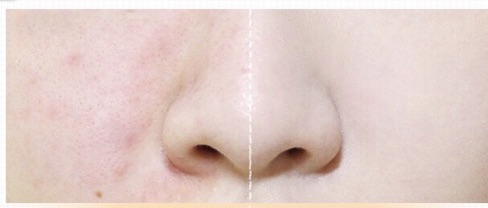 Phấn nước cushion BB cream - IMAGES