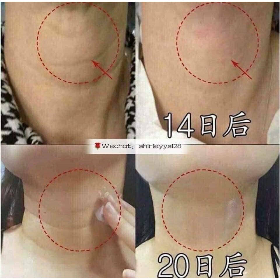 Kem cổ Vella Neck Cream mẫu mới 2020