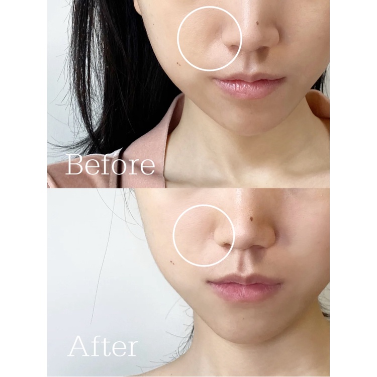 Rnw set Kem Dưỡng Da Mắt 20g Giúp Loại Bỏ Quầng Thâm Và Nếp Nhăn Hiệu Quả
