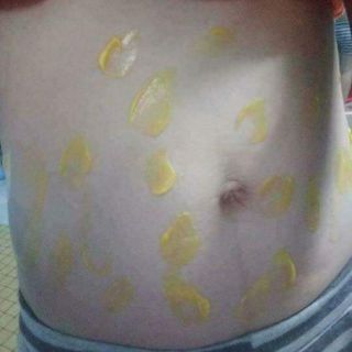 Kem tan mỡ gia truyền