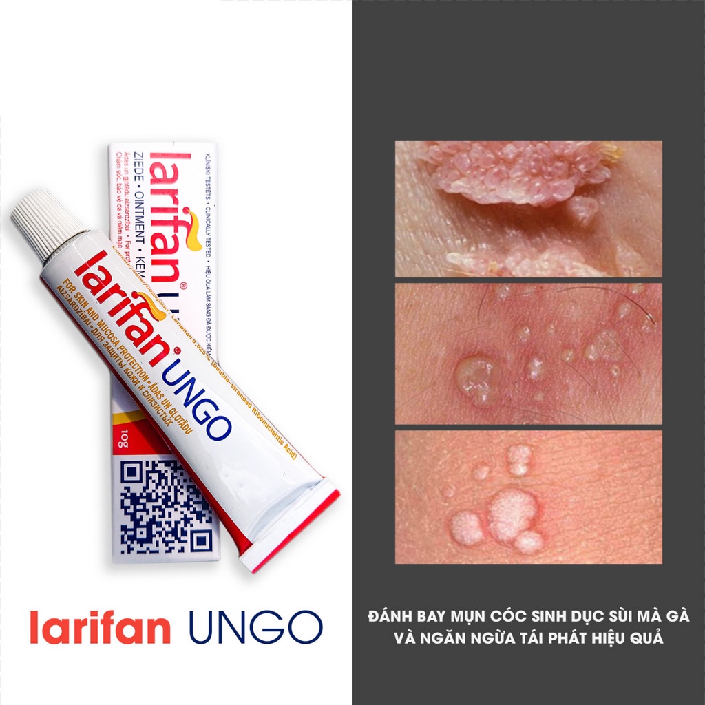 Combo Larifan + Acid Trichloroacetic (TCA) | Xử lý SÙI MÀO GÀ, MỤN CÓC SINH DỤC tại nhà