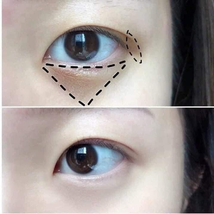 Kem dưỡng mắt dạng lăn Whitening Eye Cream Elle Vie 20g