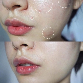 Mặt nạ phục hồi da Smas