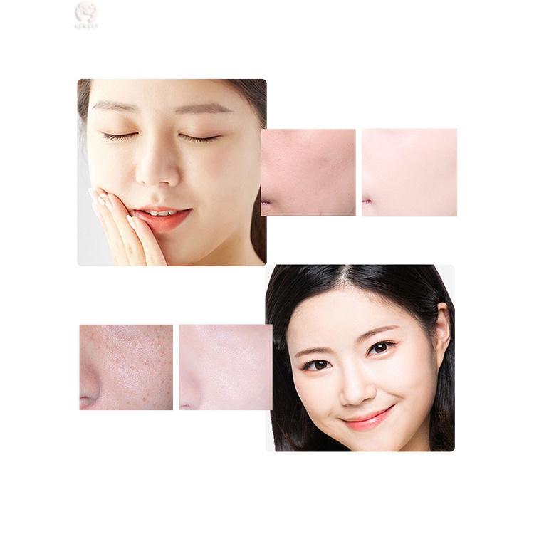 Kem Hỗ trợ giảm tàn nhang Làm Trắng Da Loại Bỏ Nám Tàn Nhang 50g TTLIFE