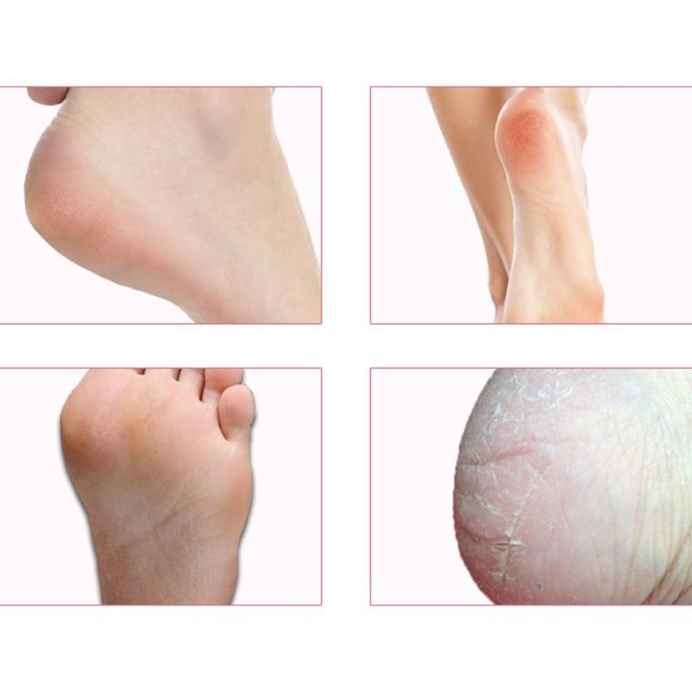 Dụng Cụ Chăm Sóc Bàn Chân Tẩy Tế Bào Chết Chất Lượng Cao|Dụng Cụ Dũa Móng Tay Chuyên Dụng