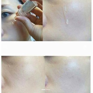 Tế bào gốc phức hợp ELRAVIE