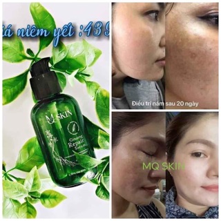 Serum mskin nhân sâm