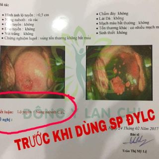 Hồng âm tiêu viêm lan chi