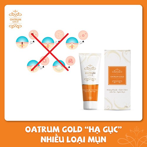 Kem bôi mụn Oatrum Gold giúp kháng khuẩn, giảm viêm, sạch mụn tuýp 20g