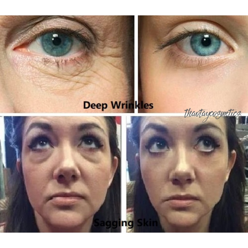 [Hàng Mỹ] Kem dưỡng mắt Olay Eyes (Crow's Feet/ Visibly Lifted Firm Eyes/ Deep Wrinkles/ Sagging Skin) | BigBuy360 - bigbuy360.vn