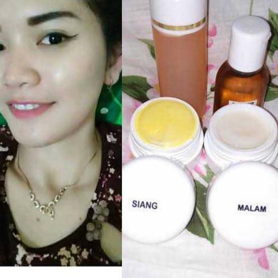 (Giảm Giá Sốc) Kem Dưỡng Da Mắt Jue 157 Chính Hãng 100% | BigBuy360 - bigbuy360.vn