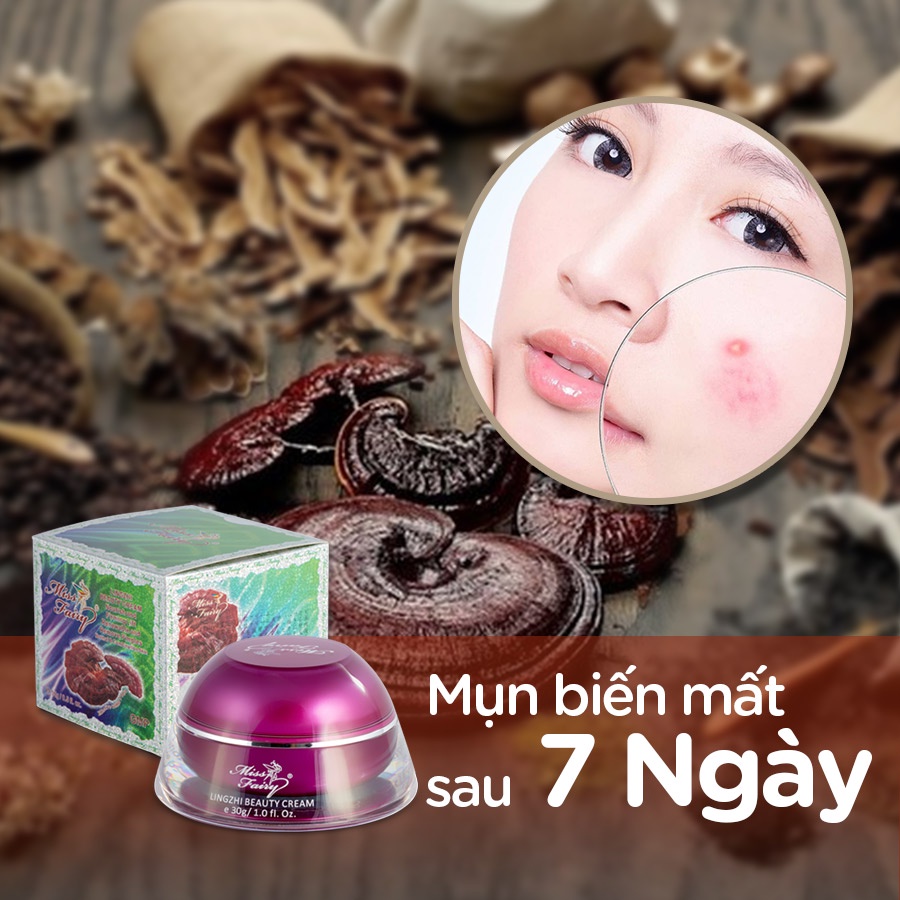 Kem mụn tinh chất Linh Chi Miss Fairy - Sạch mụn - Mờ thâm - Không để lại sẹo