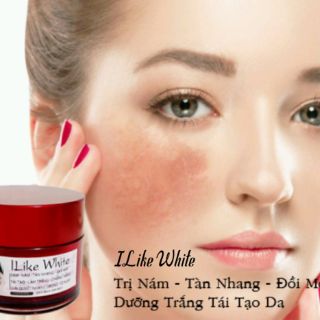 Kem Xóa Nám Tàn Nhang Trong 10 Ngày