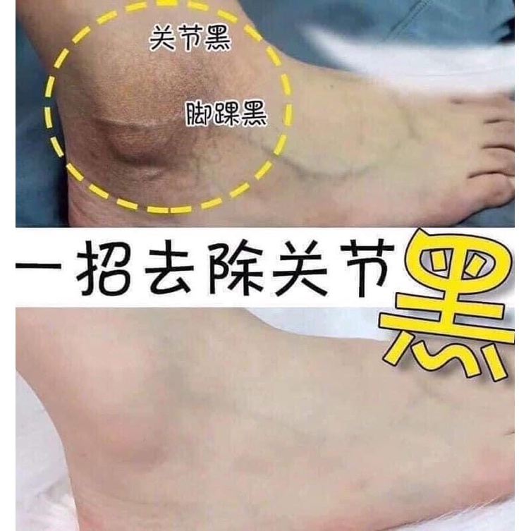 [FREE SHIP] Kem Massage Mờ Thâm Gối Nách Khuỷ tay Pibamy