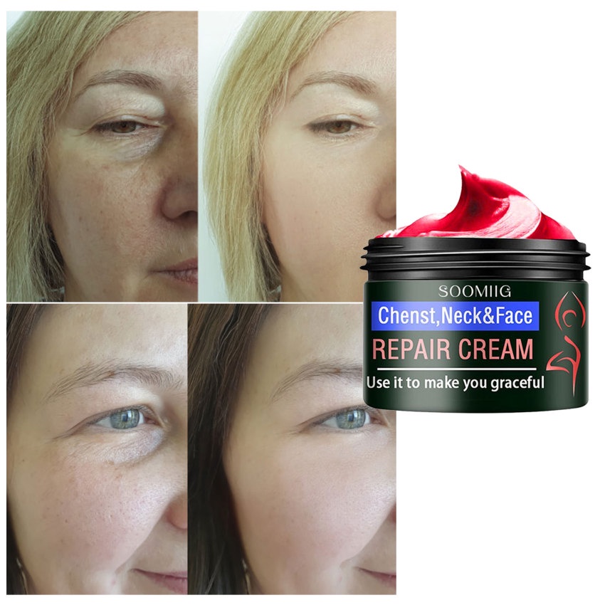 Kem Collagen Làm Trắng Da Mặt Chống Nếp Nhăn Và Làm Săn Chắc Da