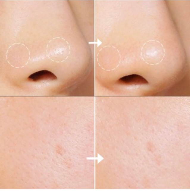 Mặt Nạ Tro Núi Lửa NGĂN NGỪA Mụ.n Đầu Đen, Chăm Sóc Lỗ Chân Lông Innisfree Super Volcanic Pore Clay Mask phiên bản 2X