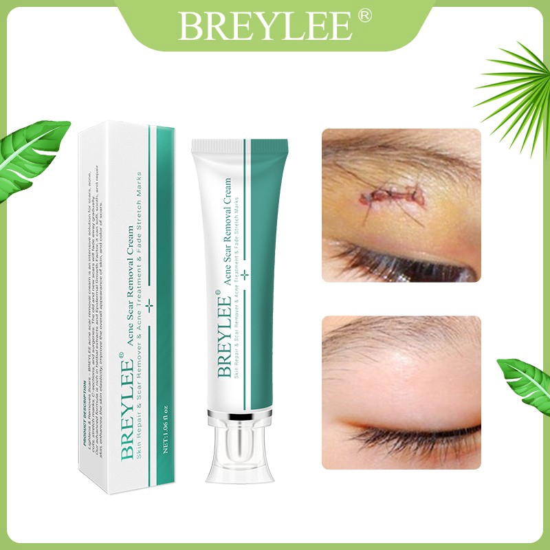 Kem Hỗ Trợ Giảm Sẹo Pimples BREYLEE Làm Sáng Da 30g | BigBuy360 - bigbuy360.vn