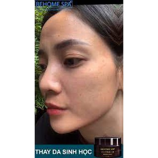 Thay da sinh học Behome Spa🍒Freeship🍒Behome Spa