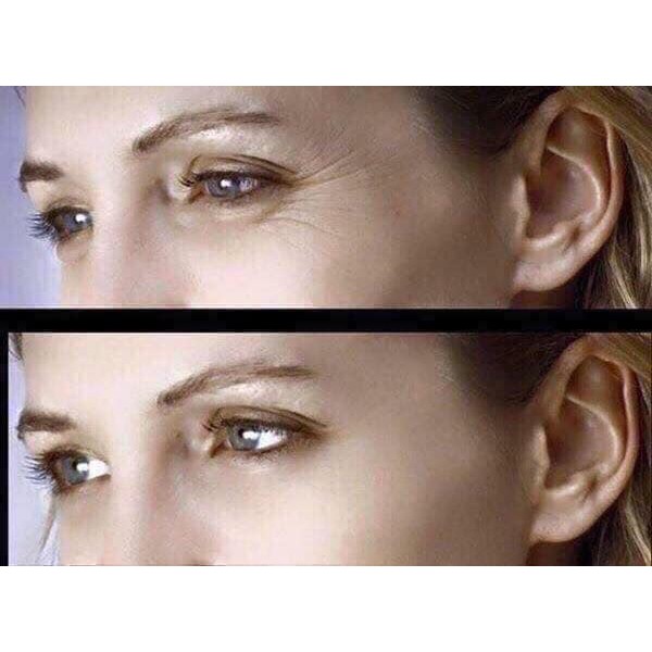 Kem Mắt Optim Eyes Filorga