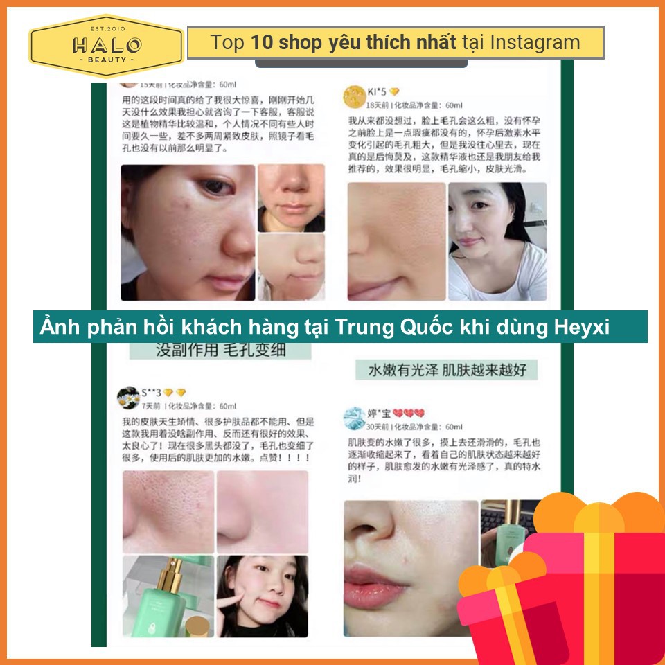 Serum Mụn Đầu Đen - Tinh Chất Heyxi Ngừa Mụn, Se Lỗ Chân Lông- Date Mới Nhất | BigBuy360 - bigbuy360.vn