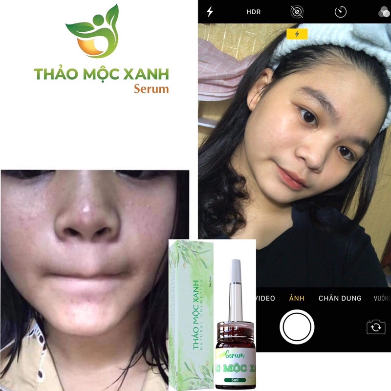 Serum Thảo mộc Xanh