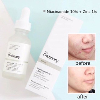 THE ORDINARY NIACINAMIDE 10% + ZIN 1%