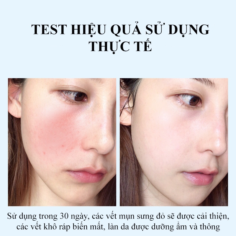 Mặt nạ dưỡng da cấp ẩm làm trắng da HIISEES