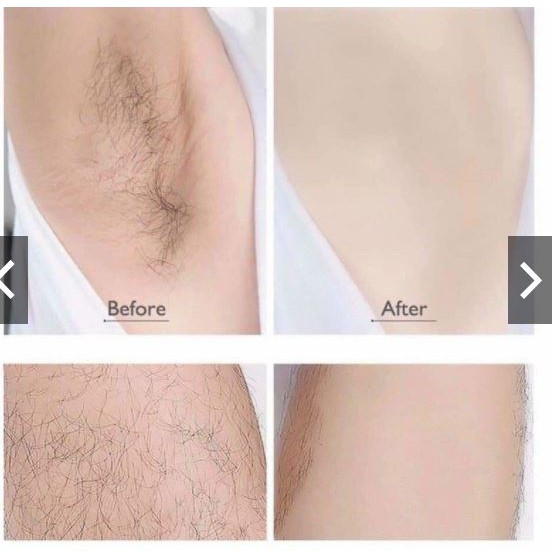 Kem Tẩy Lông DETVFO - HÀNG CHÍNH HÃNG | BigBuy360 - bigbuy360.vn