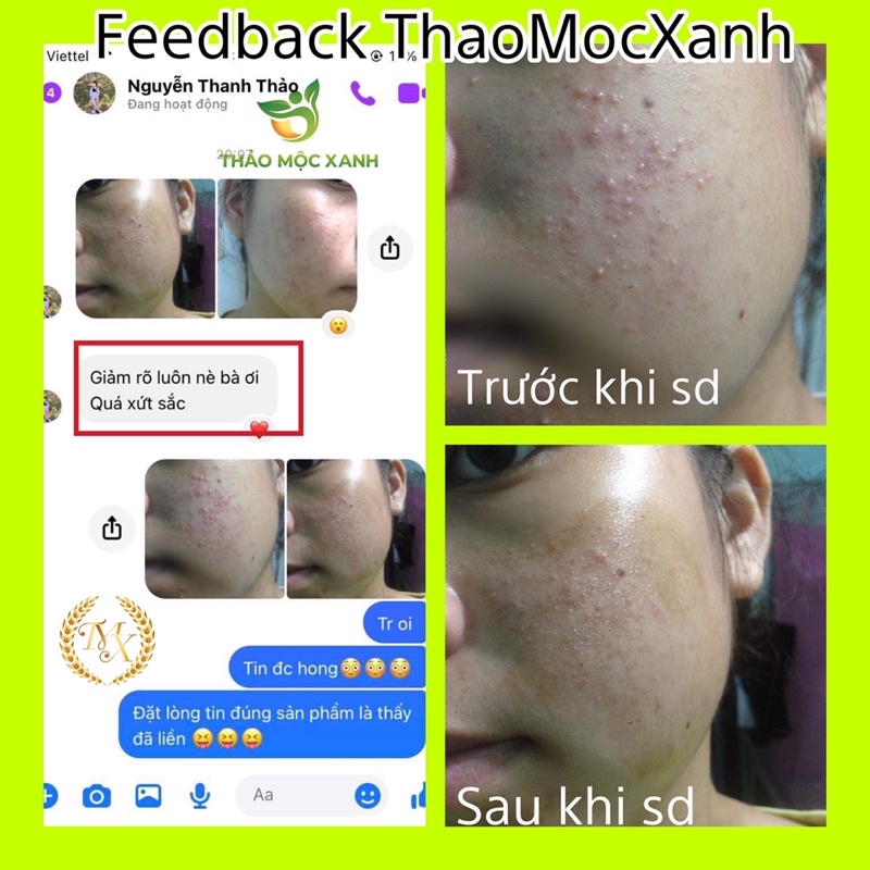 Serum thảo mộc xanh 3 lọ