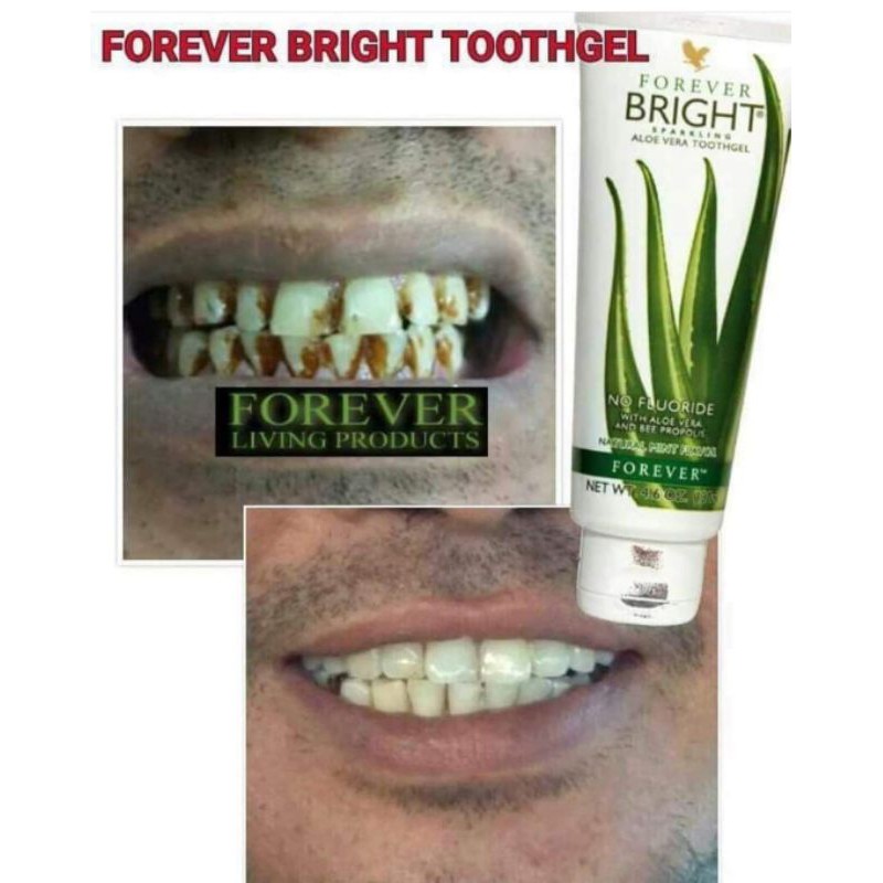 Kem đánh răng Lô hội _ Forever Bright Toothgel