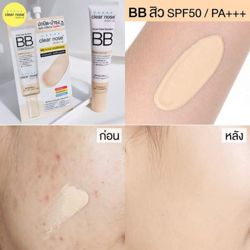 Các Tinh chất và kem BB , Clear Nose😍1 gói 8g.