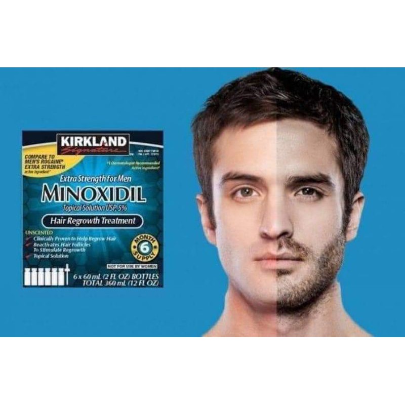 🧔🏻Thuốc Mọc Râu Tóc Kirkland Minoxidil 5% của Mỹ