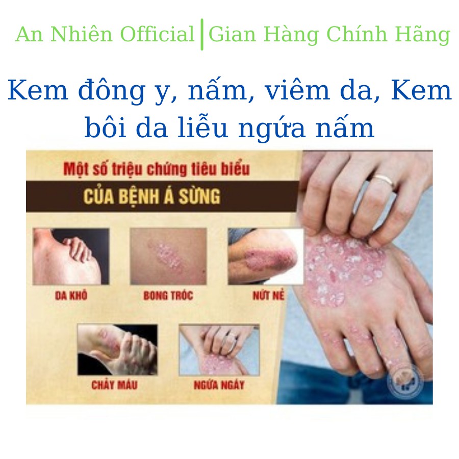 Kem Bôi Da Liễu Nấm Ngứa, ghẻ nước, hắc lào, á sừng, mề đay, tổ đỉa, vảy nến tuýp 15gr - Hàng có sẵn giao ngay | BigBuy360 - bigbuy360.vn