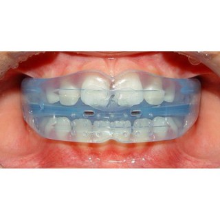 DỤNG CỤ NIỀNG RĂNG TẠI NHÀ _(CÓ BẢO HÀNH)