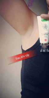 Tẩy lông Hesa doctor A