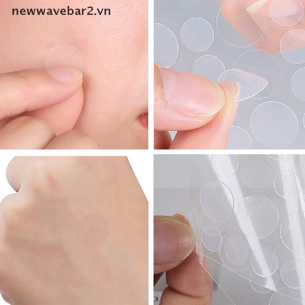 2 Miếng Dán Hỗ trợ giảm mụn Trứng Cá Và ddvn