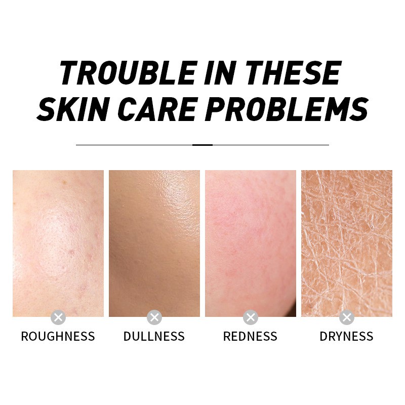 Nước Hoa Hồng Toner Hoa Anh Đào Laikou Japan Sakura Toner 100ml Cấp Ẩm Làm Dịu Da, Dưỡng Trắng, Se Khít Lcl, Giảm Mụn | BigBuy360 - bigbuy360.vn