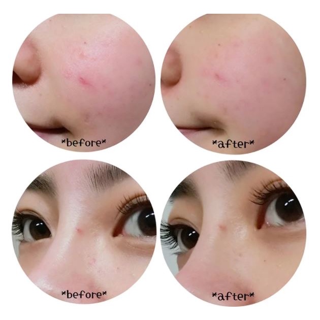 Kem Dưỡng Phục Hồi Chuyên Sâu Cho Da Mụn Medi-Peel Centella Mezzo Cream 30ml