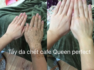 Tẩy tế bào chết Queen Perfect