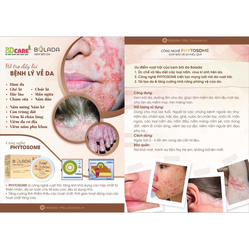 Kem bôi da Bolada phòng ngữa các bệnh ngoài da ngăn ngừa và loại bỏ các loại nấm trên da