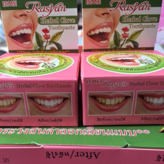 Kem trắng răng Ismi Thái lan 25g