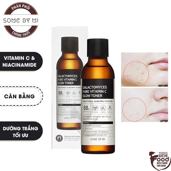 Nước Hoa Hồng Dưỡng Trắng, Some By Mi Galactomyces Pure Vitamin C Glow Toner 200ml